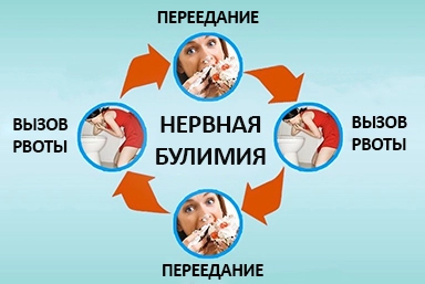 Лечение булимии в Игре